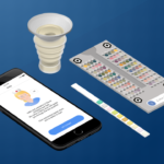 urinalysis